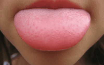 Weather Changes Lead To Moisture Retention